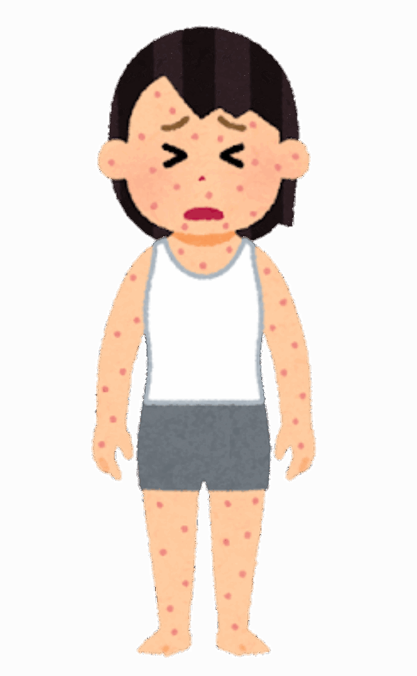 大人も注意⚠「あせも」サムネイル