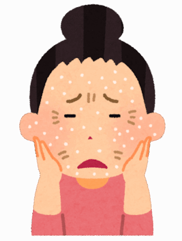⚠ご用心⚠春の５Kサムネイル